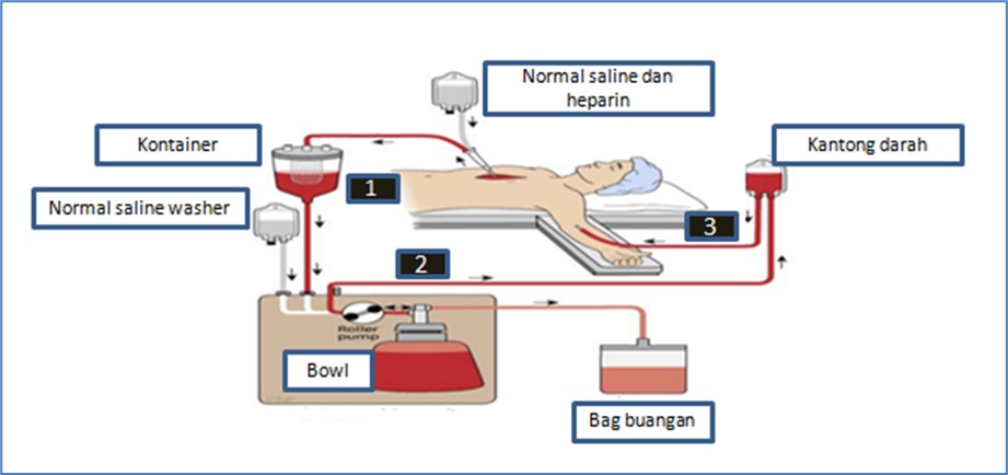 Pusat Jantung Nasional Harapan Kita